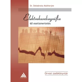 ELEKTROKARDIOGRÁFIA - 60 ESETISMERTETÉS